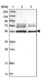 Osm antibody, PA5-54493, Invitrogen Antibodies, Western Blot image 