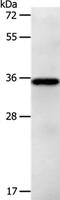 Phospholipid Phosphatase Related 5 antibody, PA5-50564, Invitrogen Antibodies, Western Blot image 