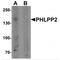 PH Domain And Leucine Rich Repeat Protein Phosphatase 2 antibody, MBS150602, MyBioSource, Western Blot image 