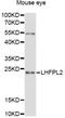 LHFPL Tetraspan Subfamily Member 2 antibody, LS-C747941, Lifespan Biosciences, Western Blot image 