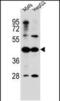 Acyl-CoA Synthetase Medium Chain Family Member 6 antibody, PA5-48406, Invitrogen Antibodies, Western Blot image 