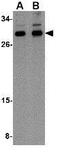 Nipsnap Homolog 3B antibody, GTX85354, GeneTex, Western Blot image 