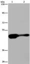 Aryl-Hydrocarbon Receptor Repressor antibody, PA5-50626, Invitrogen Antibodies, Western Blot image 