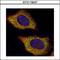 Vacuolar protein sorting-associated protein 28 homolog antibody, GTX115937, GeneTex, Immunocytochemistry image 