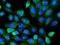 RAB7A, Member RAS Oncogene Family antibody, GTX02417, GeneTex, Immunocytochemistry image 