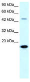 Matrix Metallopeptidase 19 antibody, TA330244, Origene, Western Blot image 