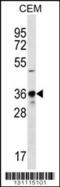 PHD antibody, 56-429, ProSci, Western Blot image 