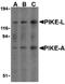 Arf-GAP with GTPase, ANK repeat and PH domain-containing protein 2 antibody, PA5-20065, Invitrogen Antibodies, Western Blot image 