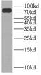 Solute Carrier Family 24 Member 4 antibody, FNab07925, FineTest, Western Blot image 