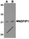 NEDD4 family-interacting protein 1 antibody, 6977, ProSci Inc, Western Blot image 
