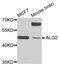 ALG2 Alpha-1,3/1,6-Mannosyltransferase antibody, A7843, ABclonal Technology, Western Blot image 