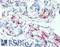 CD163 antibody, LS-B15360, Lifespan Biosciences, Immunohistochemistry paraffin image 