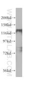 Histone Deacetylase 5 antibody, 16166-1-AP, Proteintech Group, Western Blot image 
