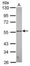 Pregnancy Specific Beta-1-Glycoprotein 9 antibody, NBP2-19980, Novus Biologicals, Western Blot image 