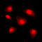 Forkhead Box O1 antibody, LS-C368599, Lifespan Biosciences, Immunofluorescence image 