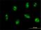 Exosome complex exonuclease RRP46 antibody, H00056915-M01, Novus Biologicals, Immunofluorescence image 