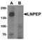 P-LAP antibody, NBP2-81854, Novus Biologicals, Western Blot image 