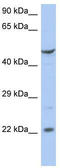 Putative zinc finger protein 826 antibody, TA339661, Origene, Western Blot image 