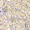 Karyopherin Subunit Alpha 6 antibody, A7363, ABclonal Technology, Immunohistochemistry paraffin image 