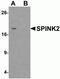 Serine Peptidase Inhibitor, Kazal Type 2 antibody, NBP2-82015, Novus Biologicals, Western Blot image 