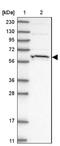 Hypermethylated in cancer 2 protein antibody, NBP1-81710, Novus Biologicals, Western Blot image 