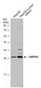 Small Nuclear Ribonucleoprotein Polypeptide B2 antibody, GTX129802, GeneTex, Western Blot image 