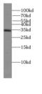 MYCL Proto-Oncogene, BHLH Transcription Factor antibody, FNab05459, FineTest, Western Blot image 