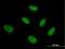 HAP3 antibody, H00004801-M03, Novus Biologicals, Immunocytochemistry image 