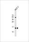 Ribosomal Protein S24 antibody, 64-081, ProSci, Western Blot image 