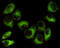 Protein Kinase AMP-Activated Non-Catalytic Subunit Beta 1 antibody, M03741-1, Boster Biological Technology, Immunocytochemistry image 