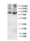 Nuclear Receptor Subfamily 3 Group C Member 1 antibody, PA1107, Boster Biological Technology, Western Blot image 