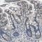 Catenin Delta 1 antibody, HPA015955, Atlas Antibodies, Immunohistochemistry frozen image 