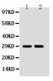 SSX Family Member 2B antibody, PA5-80074, Invitrogen Antibodies, Western Blot image 