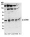 Zinc Finger CCHC-Type And RNA Binding Motif Containing 1 antibody, A304-697A, Bethyl Labs, Western Blot image 