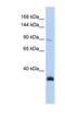 MORC Family CW-Type Zinc Finger 3 antibody, NBP1-53029, Novus Biologicals, Western Blot image 