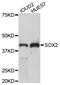 SRY-Box 2 antibody, abx127117, Abbexa, Western Blot image 