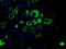 Aconitase antibody, M03096-1, Boster Biological Technology, Immunofluorescence image 