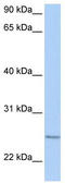 Intraflagellar Transport 27 antibody, TA346611, Origene, Western Blot image 