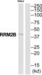Ribonucleotide Reductase Regulatory TP53 Inducible Subunit M2B antibody, abx015200, Abbexa, Western Blot image 