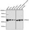 Protein Phosphatase, Mg2+/Mn2+ Dependent 1A antibody, 22-416, ProSci, Western Blot image 