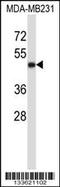 CD1a Molecule antibody, 57-104, ProSci, Western Blot image 