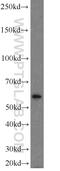 Polo Like Kinase 5 antibody, 21299-1-AP, Proteintech Group, Western Blot image 