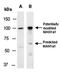 Lysine Demethylase 4E antibody, orb67174, Biorbyt, Western Blot image 
