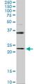 Ras-related protein Rab-31 antibody, H00011031-M03, Novus Biologicals, Western Blot image 
