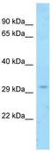 Caveolae Associated Protein 3 antibody, TA339797, Origene, Western Blot image 