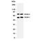 Regulator of G-protein signaling 9 antibody, R31365, NSJ Bioreagents, Western Blot image 