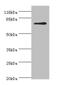 Methylenetetrahydrofolate Reductase antibody, A50390-100, Epigentek, Western Blot image 
