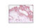 Neurotrophic Receptor Tyrosine Kinase 2 antibody, 4607S, Cell Signaling Technology, Immunohistochemistry paraffin image 