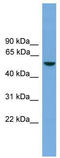 Farnesoid X receptor beta splice variant 5 antibody, TA331445, Origene, Western Blot image 
