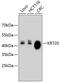 Keratin 20 antibody, 14-013, ProSci, Western Blot image 